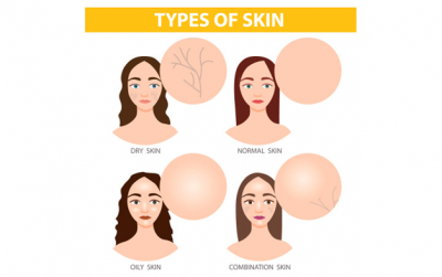 How To Determine Your Skin Type?