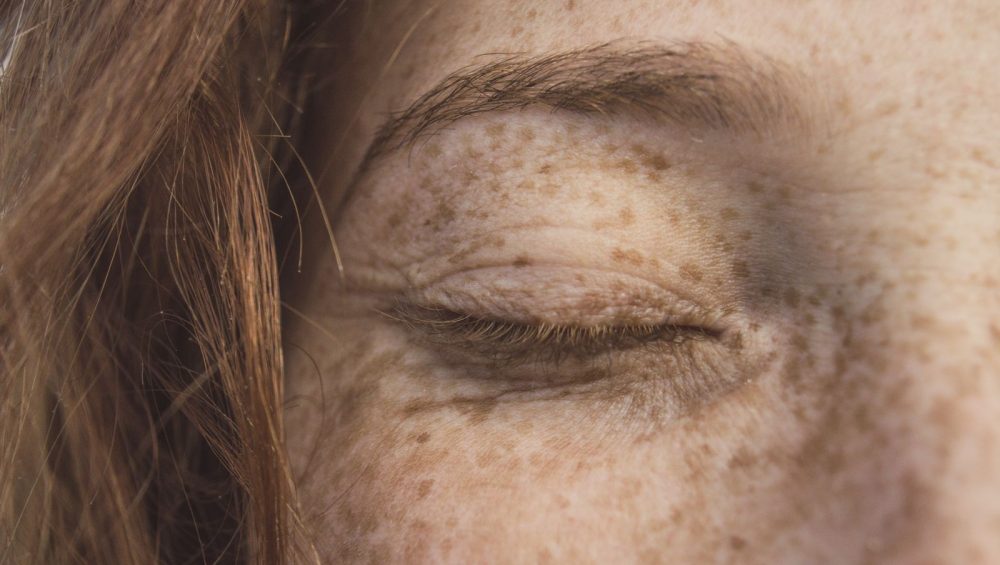 Close-up of freckled skin