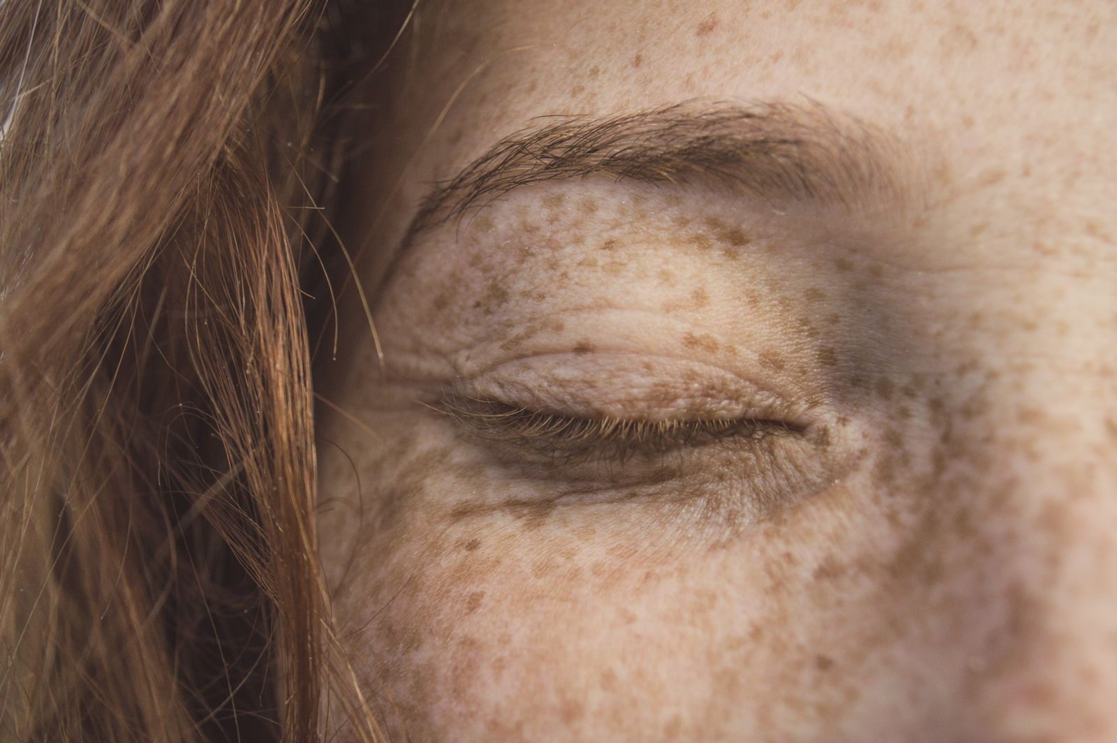 Close-up of freckled skin