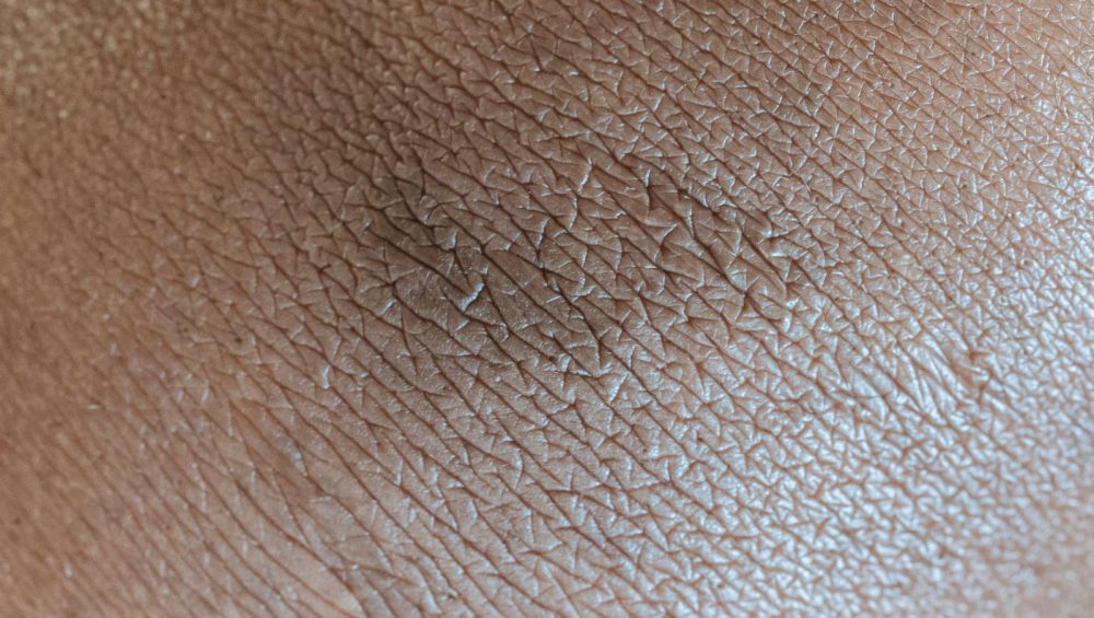 Close-up of skin surface texture