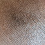 Close-up of skin surface texture