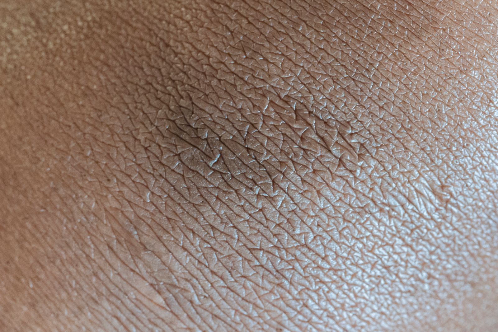 Close-up of skin surface texture