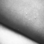 Water droplets resting on bare skin