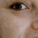 Close-up of bare skin around the eye, nose and cheek, freckles visible, no makeup