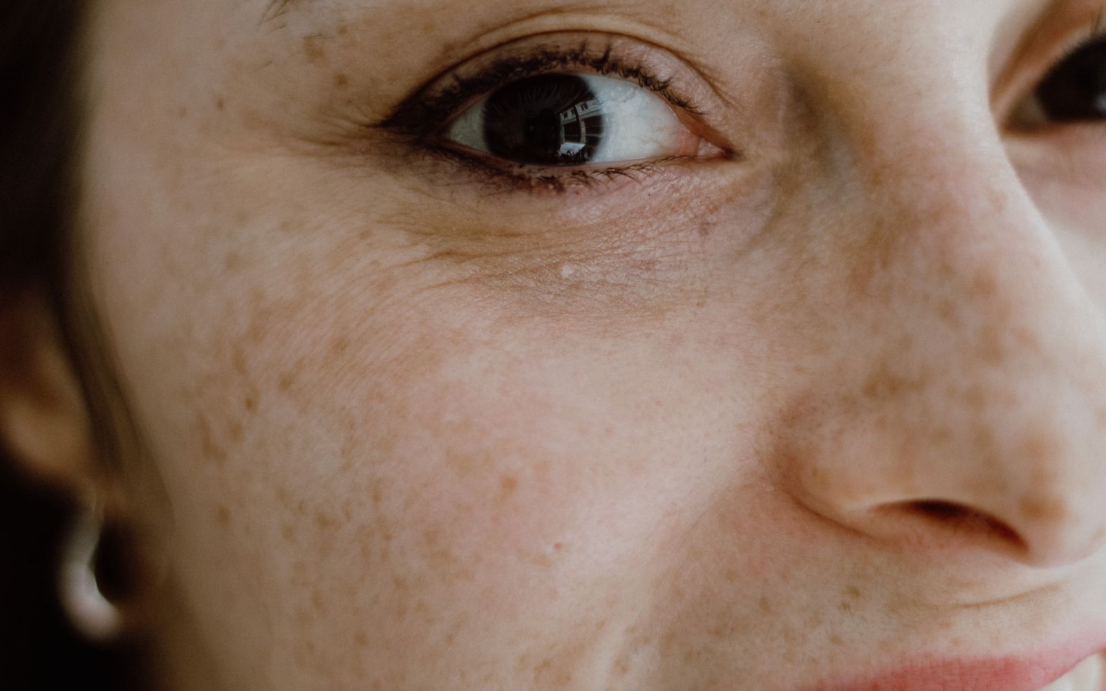 Close-up of bare skin around the eye, nose and cheek, freckles visible, no makeup