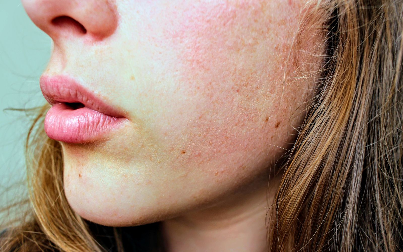 Close view of a woman's cheek, jaw and lips in natural daylight, bare skin with its fine texture and a little redness visible
