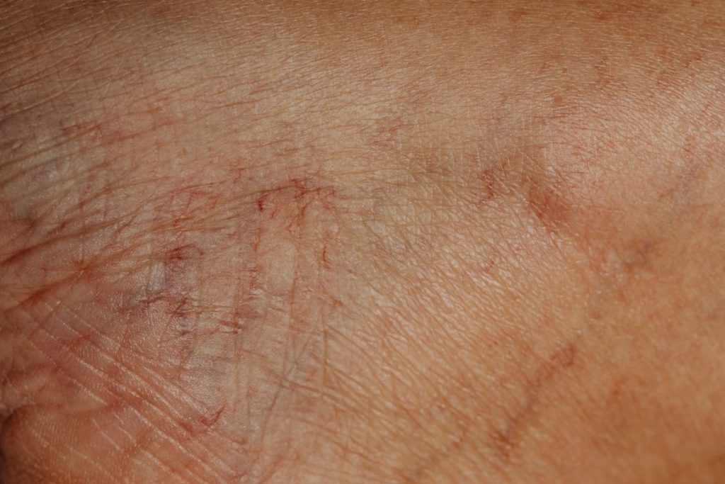 Macro close-up of fine lines and dry texture on the skin