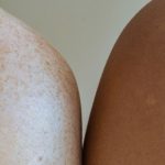 Close-up of a freckled shoulder beside another person's shoulder, natural light
