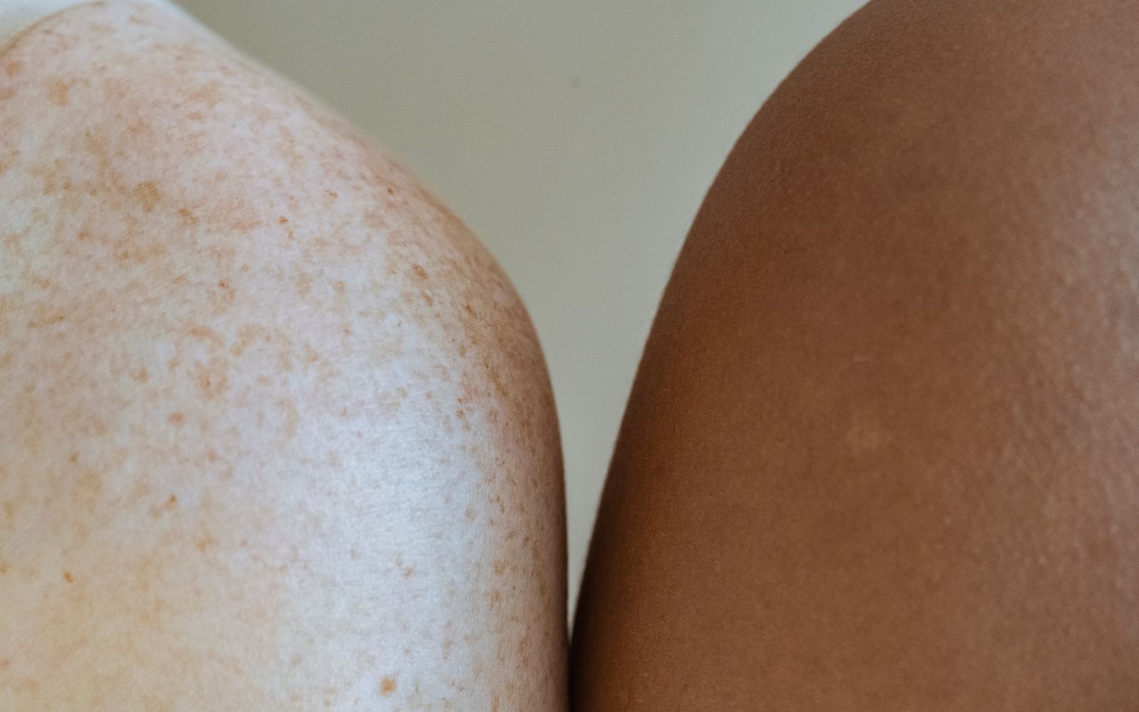 Close-up of a freckled shoulder beside another person's shoulder, natural light